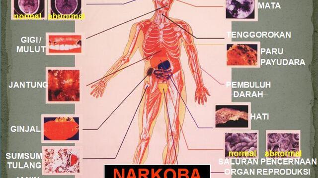 Dampak Narkoba terhadap Kesehatan yang Perlu Kamu Ketahui